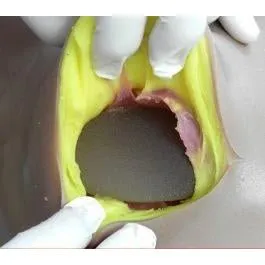Mastotrainer Breast Surgical Trainer, Small And Asymmetrical