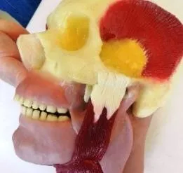 Oral and Maxillo Facial Surgery Simulator with Optional Fractures