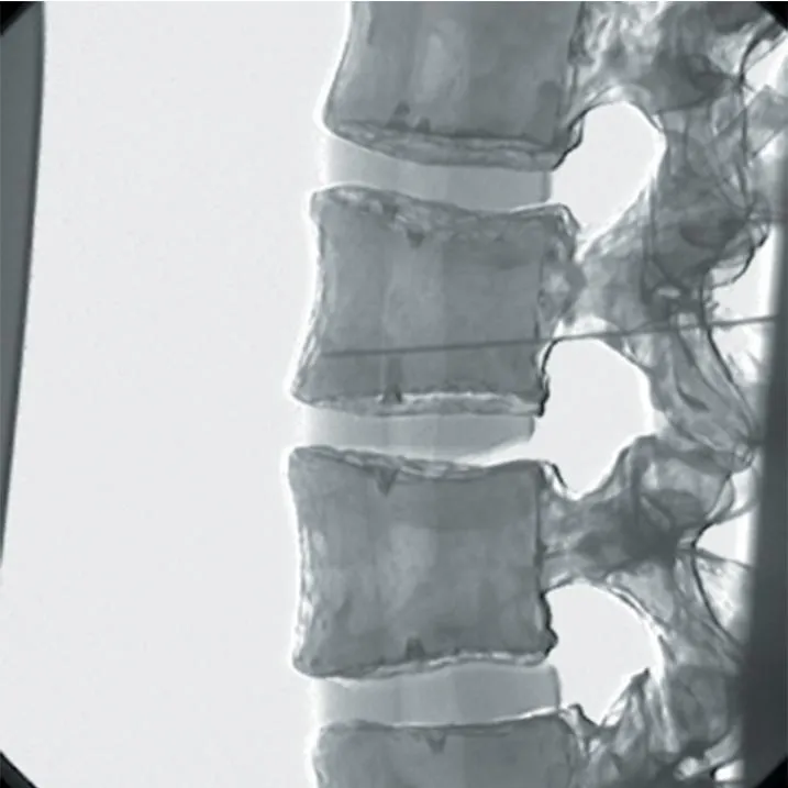 Pain Relief and Nerve Block Manikin