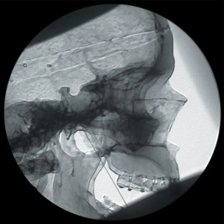 Pain Relief and Nerve Block Manikin