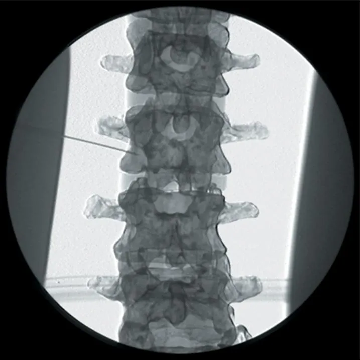 Pain Relief and Nerve Block Manikin