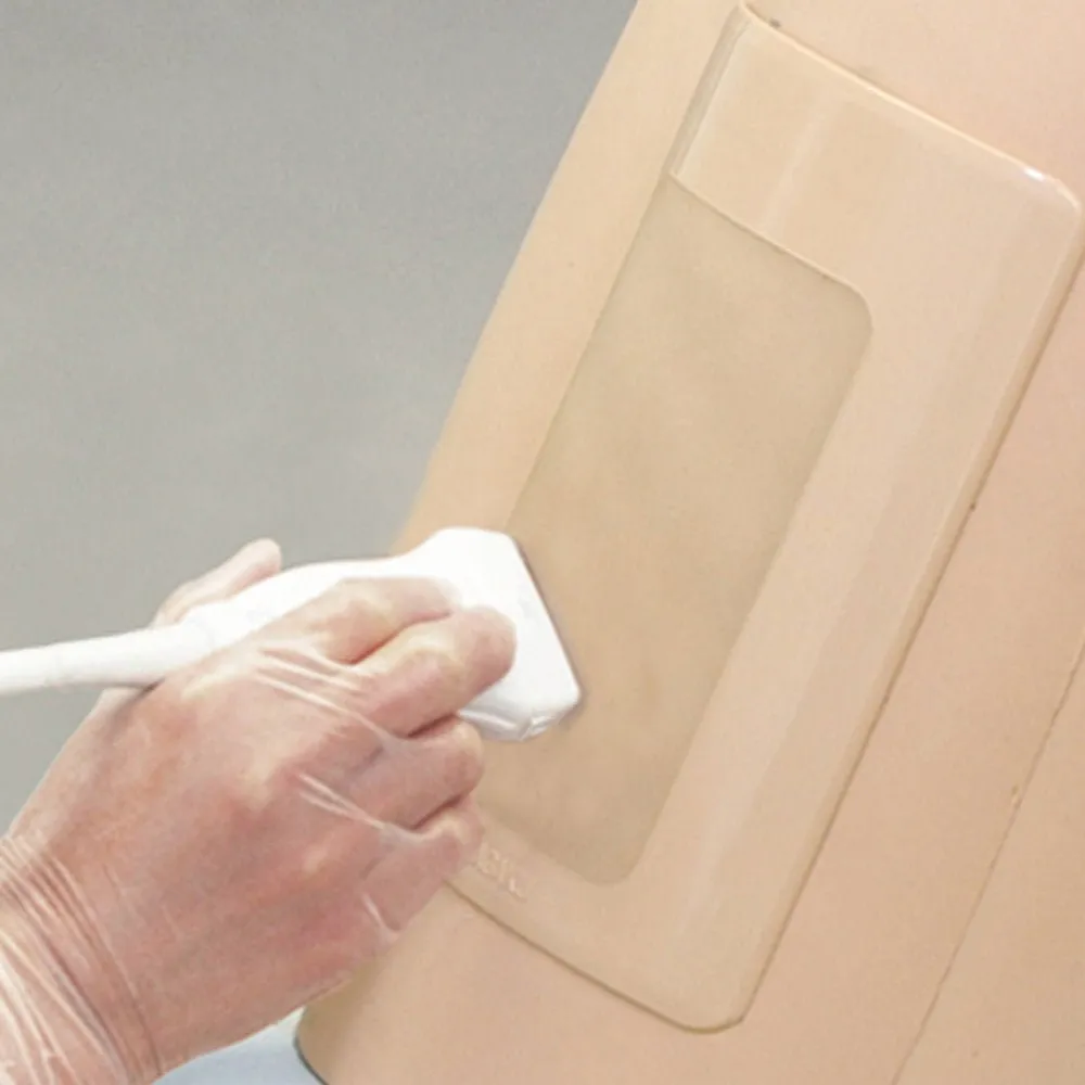 Ultrasound-Guided Thoracentesis Simulator