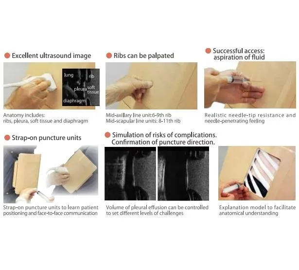 Ultrasound-Guided Thoracentesis Simulator